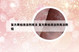 復(fù)方黃柏液涂劑用法 復(fù)方黃柏液涂劑用法教程