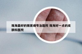 珠海最好的銀屑病專治醫(yī)院 珠海好一點的皮膚科醫(yī)院