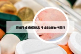德州牛皮癬保健品 牛皮膚癬治療醫(yī)院