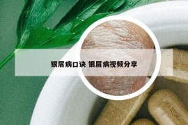 銀屑病口訣 銀屑病視頻分享
