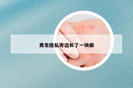 男生隱私旁邊長了一塊癬