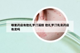 哪里藥店有他扎羅汀凝膠 他扎羅汀乳膏藥店有賣嗎