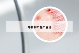牛皮癬產(chǎn)品廣告語(yǔ)