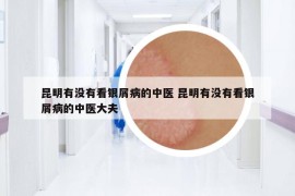 昆明有沒(méi)有看銀屑病的中醫(yī) 昆明有沒(méi)有看銀屑病的中醫(yī)大夫