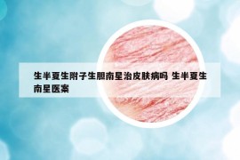 生半夏生附子生膽南星治皮膚病嗎 生半夏生南星醫(yī)案