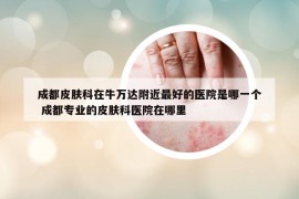 成都皮膚科在牛萬達附近最好的醫(yī)院是哪一個 成都專業(yè)的皮膚科醫(yī)院在哪里