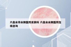 六盤水市水剛醫(yī)院皮膚科 六盤水水剛醫(yī)院在線咨詢