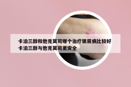 卡泊三醇和他克莫司哪個(gè)治療銀屑病比較好 卡泊三醇與他克莫司更安全