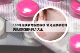 100種皮膚病對(duì)照?qǐng)D癥狀 常見皮膚病的種類及癥狀圖片簡(jiǎn)介大全