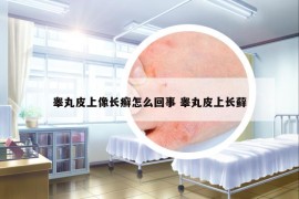 睪丸皮上像長(zhǎng)癬怎么回事 睪丸皮上長(zhǎng)蘚