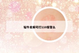 貼牛皮癬可打110報(bào)警么