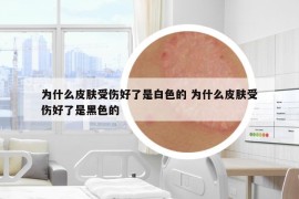 為什么皮膚受傷好了是白色的 為什么皮膚受傷好了是黑色的