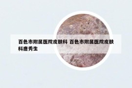 百色市附屬醫(yī)院皮膚科 百色市附屬醫(yī)院皮膚科唐秀生