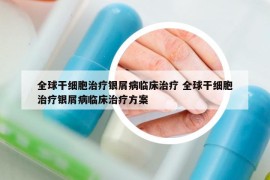 全球干細胞治療銀屑病臨床治療 全球干細胞治療銀屑病臨床治療方案