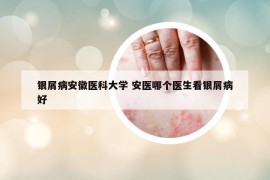 銀屑病安徽醫(yī)科大學 安醫(yī)哪個醫(yī)生看銀屑病好