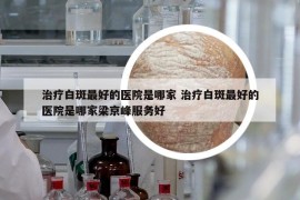 治療白斑最好的醫(yī)院是哪家 治療白斑最好的醫(yī)院是哪家梁京峰服務(wù)好