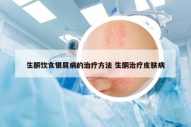 生酮飲食銀屑病的治療方法 生酮治療皮膚病
