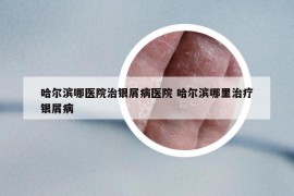 哈爾濱哪醫(yī)院治銀屑病醫(yī)院 哈爾濱哪里治療銀屑病