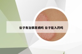 谷子有治銀屑病嗎 谷子能入藥嗎