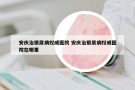 安慶治銀屑病權(quán)威醫(yī)院 安慶治銀屑病權(quán)威醫(yī)院在哪里
