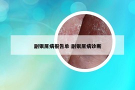 副銀屑病報告單 副銀屑病診斷