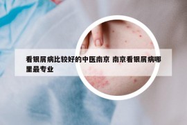 看銀屑病比較好的中醫(yī)南京 南京看銀屑病哪里最專業(yè)