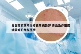 青島那家醫(yī)院治療銀屑病最好 青島治療銀屑病最好的?？漆t(yī)院