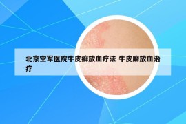 北京空軍醫(yī)院牛皮癬放血療法 牛皮廨放血治療
