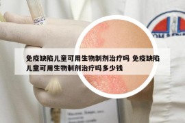 免疫缺陷兒童可用生物制劑治療嗎 免疫缺陷兒童可用生物制劑治療嗎多少錢