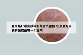 北京最好看皮膚科的是什么醫(yī)院 北京最好皮膚科醫(yī)院是哪一個醫(yī)院