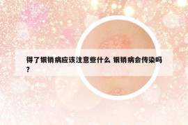 得了銀銷病應(yīng)該注意些什么 銀銷病會(huì)傳染嗎?
