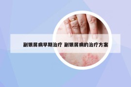 副銀屑病早期治療 副銀屑病的治療方案