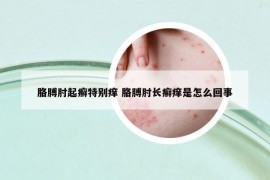 胳膊肘起癬特別癢 胳膊肘長癬癢是怎么回事