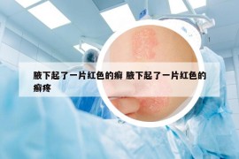 腋下起了一片紅色的癬 腋下起了一片紅色的癬疼