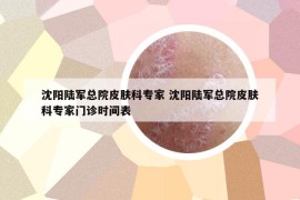 沈陽陸軍總院皮膚科專家 沈陽陸軍總院皮膚科專家門診時間表