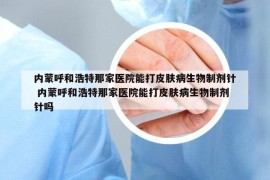 內(nèi)蒙呼和浩特那家醫(yī)院能打皮膚病生物制劑針 內(nèi)蒙呼和浩特那家醫(yī)院能打皮膚病生物制劑針嗎