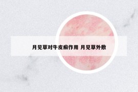 月見草對(duì)牛皮癬作用 月見草外敷