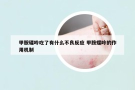 甲胺碟呤吃了有什么不良反應(yīng) 甲胺蝶呤的作用機制