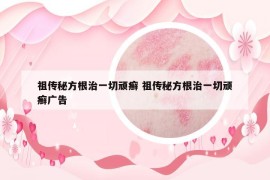 祖?zhèn)髅胤礁我磺蓄B癬 祖?zhèn)髅胤礁我磺蓄B癬廣告