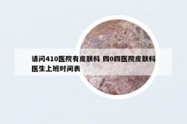 請問410醫(yī)院有皮膚科 四0四醫(yī)院皮膚科醫(yī)生上班時(shí)間表