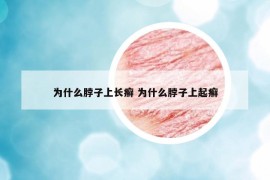為什么脖子上長(zhǎng)癬 為什么脖子上起癬