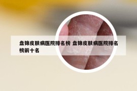盤錦皮膚病醫(yī)院排名榜 盤錦皮膚病醫(yī)院排名榜前十名