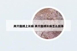 兩只胳膊上長癬 兩只胳膊長癬怎么回事