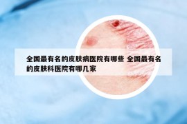 全國最有名的皮膚病醫(yī)院有哪些 全國最有名的皮膚科醫(yī)院有哪幾家