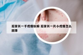 后背長(zhǎng)一千疙瘩似癬 后背長(zhǎng)一片小疙瘩怎么回事