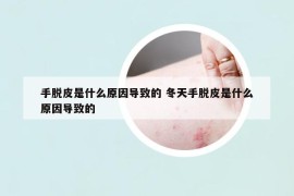 手脫皮是什么原因導致的 冬天手脫皮是什么原因導致的