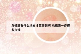 烏根清有什么地方才買得到啊 烏根清一療程多少錢