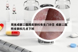 周末成都二醫(yī)院皮膚科有無門診否 成都二醫(yī)院皮膚科幾點(diǎn)下班