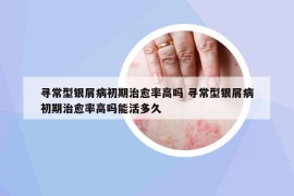 尋常型銀屑病初期治愈率高嗎 尋常型銀屑病初期治愈率高嗎能活多久