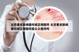 北京看皮膚病最權(quán)威正規(guī)醫(yī)院 北京看皮膚病最權(quán)威正規(guī)醫(yī)院是公立醫(yī)院嗎